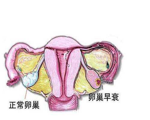 卵巢早衰患者试管移植成功后怎么保胎？ 代怀价格